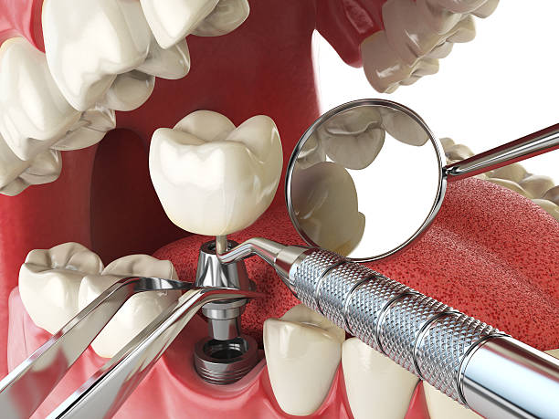 Best Emergency Orthodontic Repairs in Weber City, VA